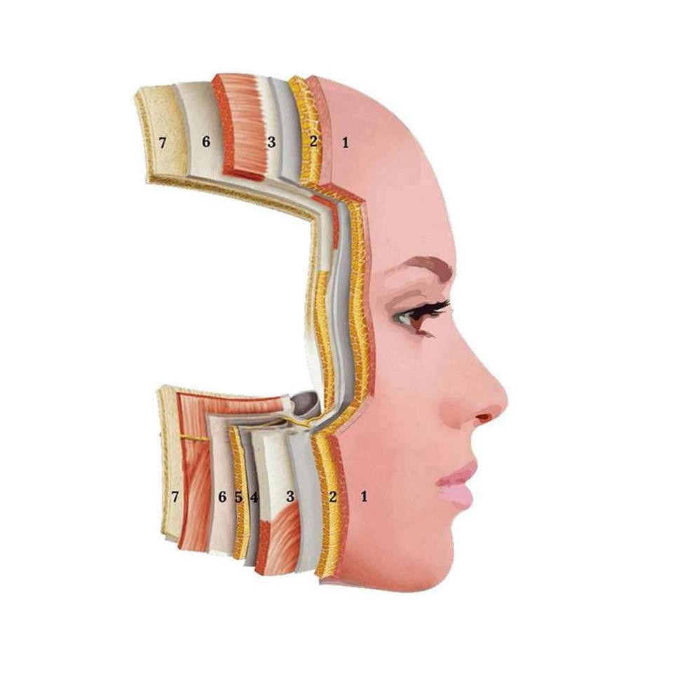 Diagram of facial skin layers and the SMAS layer for HIFU MULTI-X
